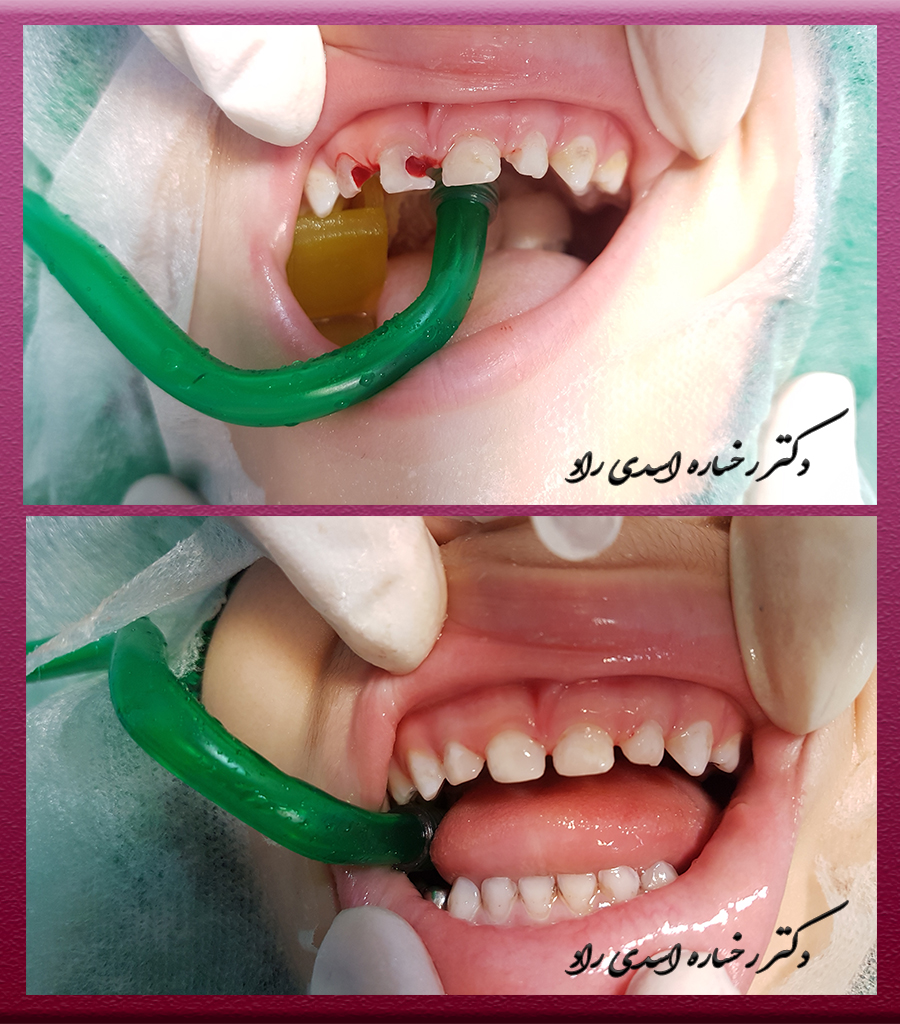 دندانپزشکی تحت بیهوشی