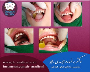 دندانپزشکی بیهوشی